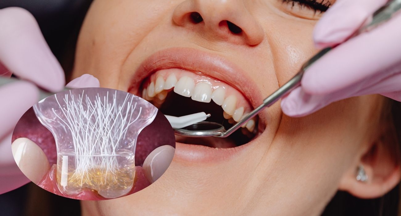 Científicos desarrollan parche dental que podría regenerar tejidos del diente. Foto: Canva y Q'pasa.