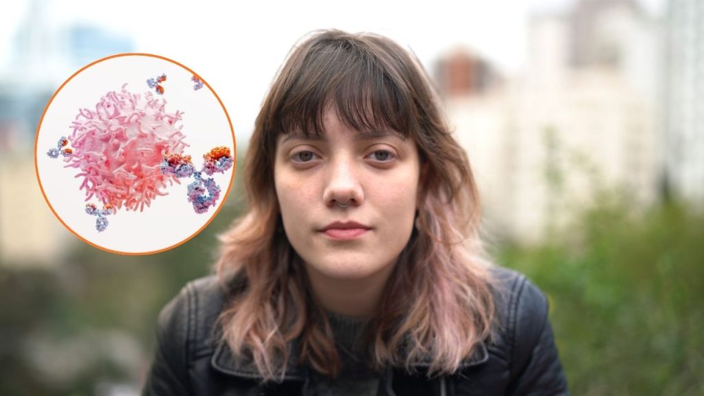 Lupus: cuando el sistema inmune, protector de nuestra salud, se convierte en adversario. Foto: GSK.